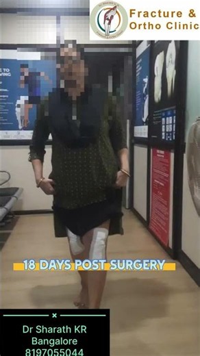 From pain with every step to walking confidently in just 18 days after bilateral knee replacement