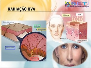 Radiação UV saiba sobre os efeitos que causa em sua pele