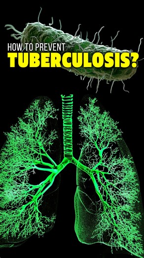 12K views · 205 reactions | How to prevent tuberculosis transmission #science #health #tuberculosis | Doctor ASKY | Facebook