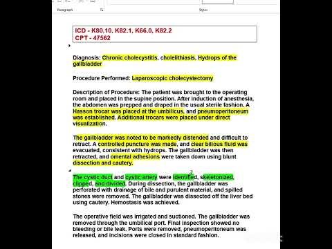 (ENGLISH VERSION) Learn how to code Laparoscopic Cholecystectomy using the correct CPT and ICD.