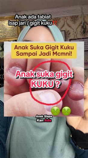Finger Essence Lotion for Kids: A Solution for Nail Biting
