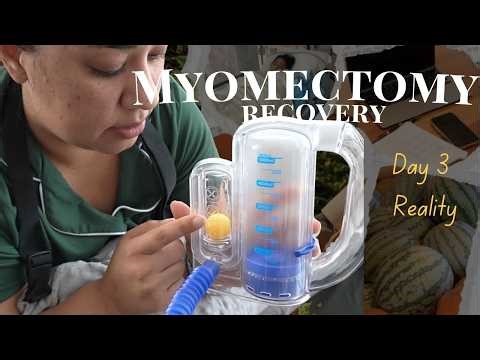 Myomectomy Recovery Day 3: I Still Can't Stand Up Straight