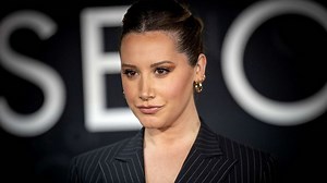 Ashley Tisdale shares struggle with hair loss: What to know about alopecia