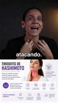 Hashimoto: la enfermedad que muchas mujeres tienen sin saberlo.
