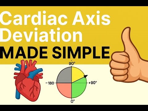 Determining QRS Axis