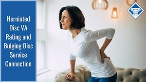 Herniated Disc VA Rating