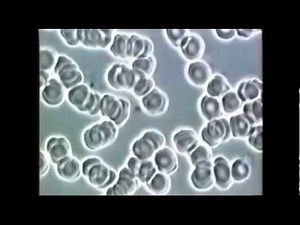 Blood Samples Before After Pycnogenol OPC 3 YouTube
