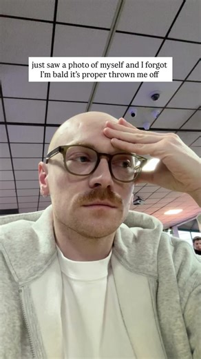 I really forgot I was bald. Hairless. Nothing. #bald