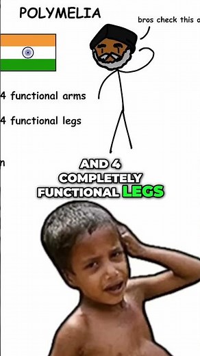 Deepak Paswan: The Man With Four Arms And Legs! #shorts