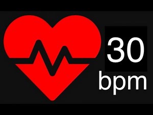 Heartbeat - 30 beats per minute for 1 hour