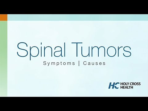 Spinal Tumors: Symptoms, Causes