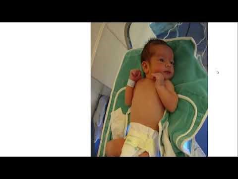 Jaundice in Newborns - Pediatric Educational Committee: Dr. Y. Bouskia