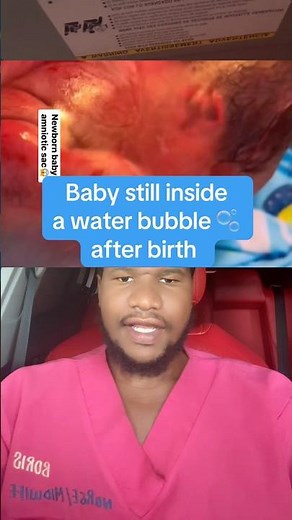 What is en caul birth