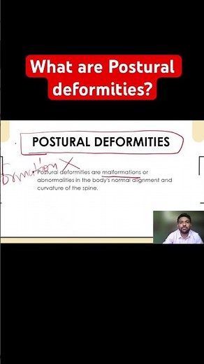 Postural Deformities in Physical Education | Causes, Effects & Correction | Rahul Sir Lecture