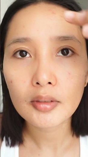 Oxecure Acne Clear Oil Control Moisturizer Review #shorts