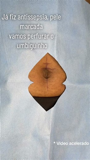Perfuração em umbigo com joalheria em titânio grau implante✨ Você tem?? • • • #piercing #piercer #piercinglovers #piercingvideo #viral #perfuracaocorporal #titanio