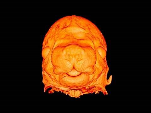 High resolution episcopic microscopy (HREM)