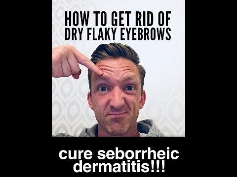 How To Get Rid Of Dry Flaky Eyebrows Seborrheic dermatitis Dandruff WORKS