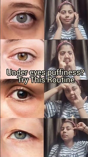 Remove Under Eye Puffiness Naturally | Face Yoga for Dark Circles & Eye Bags | Instant Eye Lift