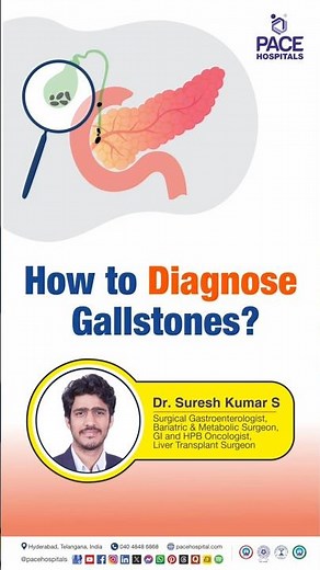 How to Diagnose Gallstones? | Diagnostic Tests for Gallstones #gallstones