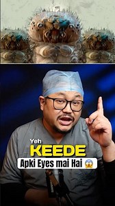 Cause of Itching, Red Eyelids! | Dr. Explains