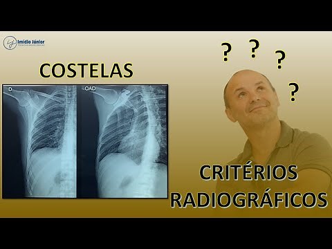 ✅ Ribs (Hemithorax, Costal Arches) - Radiographic Criteria | Essential Tips for Radiology