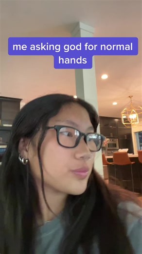 #polydactyly #foyou #foryoupage