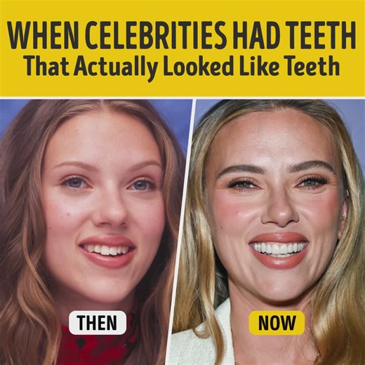 When Celebrities Had Teeth That Actually Looked Like Teeth | Bright Side