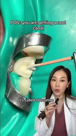 Getting a root canal on a front tooth. #rootcanal #cavity #dentist #dentalwork