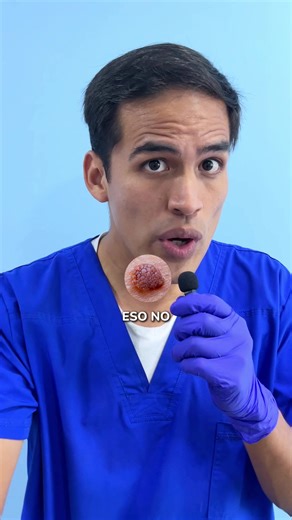 Verrugas genitales: Diagnóstico y tratamiento del VPH
