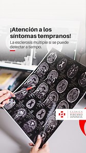 🧠 La esclerosis múltiple no aparece de un día para otro. Sus primeros síntomas pueden ser sutiles, pero reconocerlos a tiempo hace la diferencia. ​ Hoy queremos reforzar la importancia del diagnóstico temprano. 👩‍⚕️👨‍⚕️​ Recuerda que puedes agendar una cita con nuestros neurólogos especialistas a través de estos canales: ​ 1. Nuestra app: https://bit.ly/AppAPJ22​ 2. Nuestra web: bit.ly/ClínicaCentenario​ 3. Vía WhatsApp: wa.me/5112088000​ 4. Vía chatbot: bit.ly/ClínicaCentenario​ 5. Llámanos 