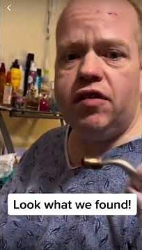 Abscess pimples cysts popped