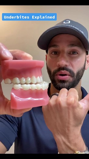 Treating Underbites with Invisalign, Braces, and Rubber Bands