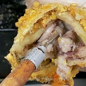 273K views · 3K reactions | Super Thick Toenails? See How High-Risk Cutting Is Done | Healthy Pathways | Facebook