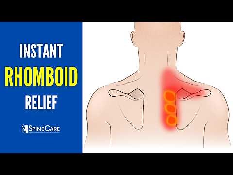 How to INSTANTLY Relieve Rhomboid Muscle Pain