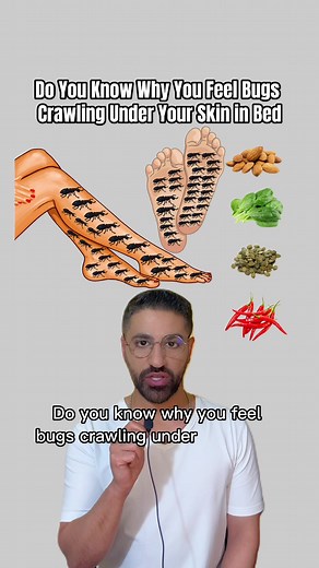 Sensation of Insects Crawling: Causes and Prevention