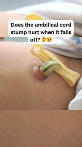 1.3M views · 5.8K reactions | ✨ Did you know the umbilical cord...
