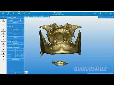 RealGUIDE Tutorial: Importing and Cleaning Dual Scan Records