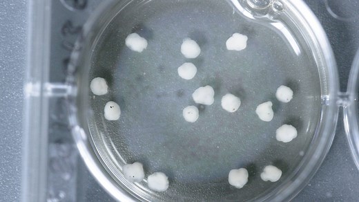 How to Grow Cerebral Organoids from Human Pluripotent Stem Cells | STEMCELL Technologies