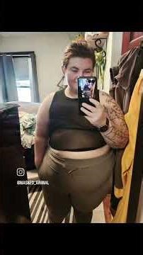 Top Surgery Recovery