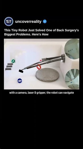 This Tiny Robot Just Solved One of Back Surgery's Biggest Problems #robot #shorts