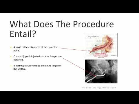 Retrograde Urethrogram & voiding Cystourethrogram