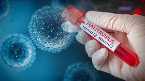 Molecular microbiologist says hantavirus contact tracing is working