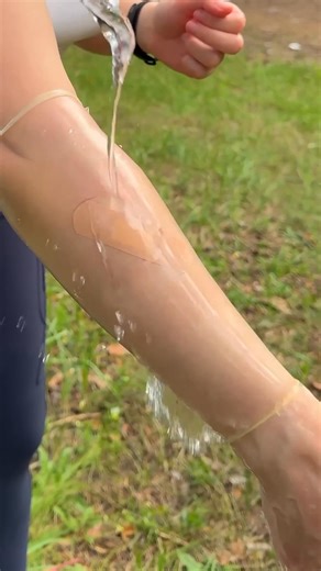 Survival Medicine #outdoors #bushcraft #survival #camping | Mr.Blank