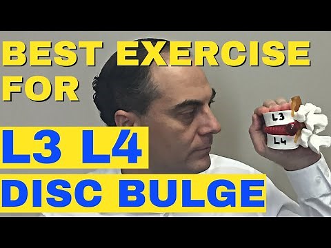 Best Exercise For L3-L4 Disc Bulge, L3-L4 Disc Herniation Dr Walter Salubro Chiropractor in Vaughan
