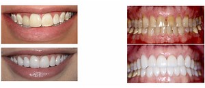 Services - Vivid Smile Dental