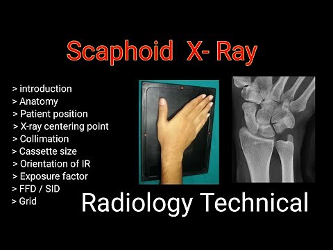 Scaphoid bone PA view ## wrist joint # upper limb radiography || By BL Kumawat