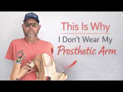 Why My Prosthetic Doesn’t Work for Me Anymore.