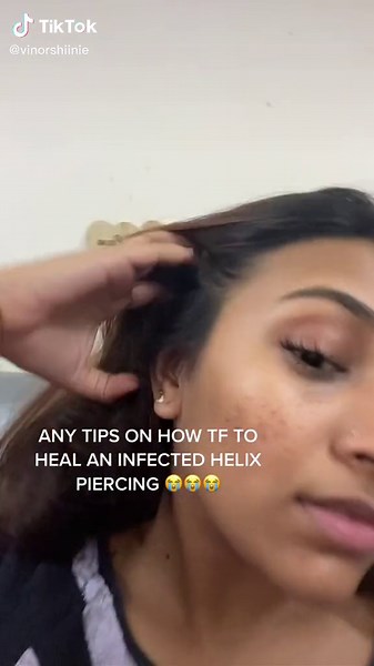 How to Heal an Infected Helix Piercing - Expert Tips