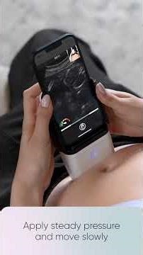 Clinician guided Pulsenmore patient onboarding